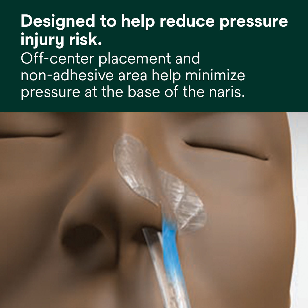 (1) Nasogastric Securement Device: Designed to help reduce pressure injury risk