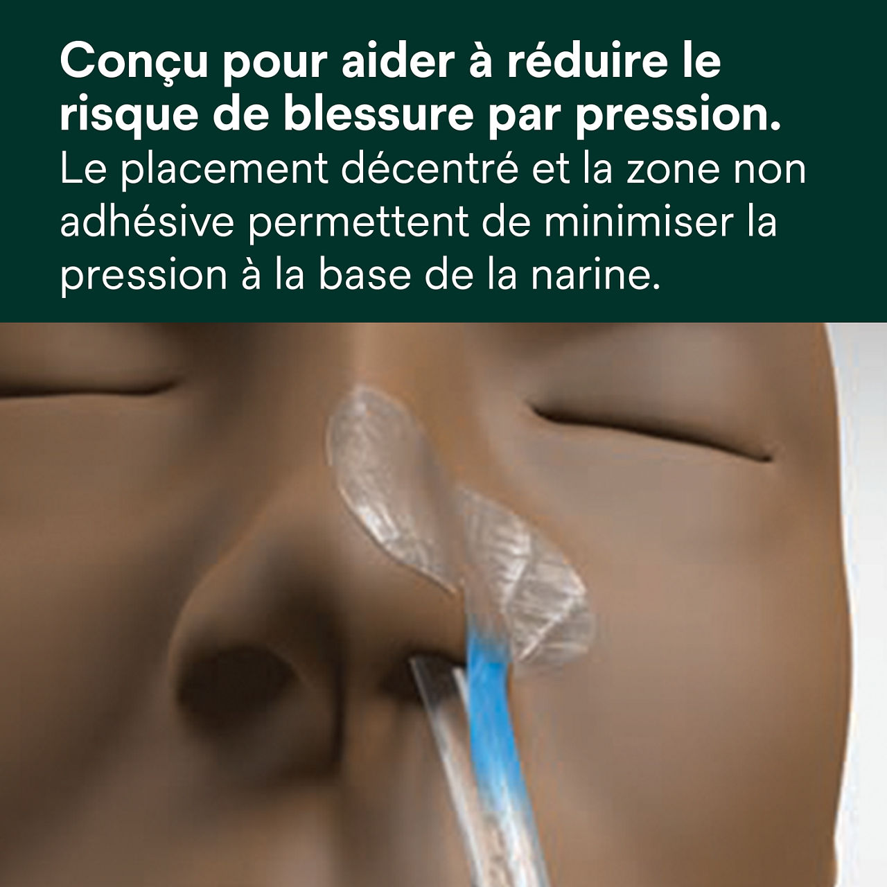 (1) Dispositif de fixation nasogastrique : Conçu pour aider à réduire le risque de blessure par pression