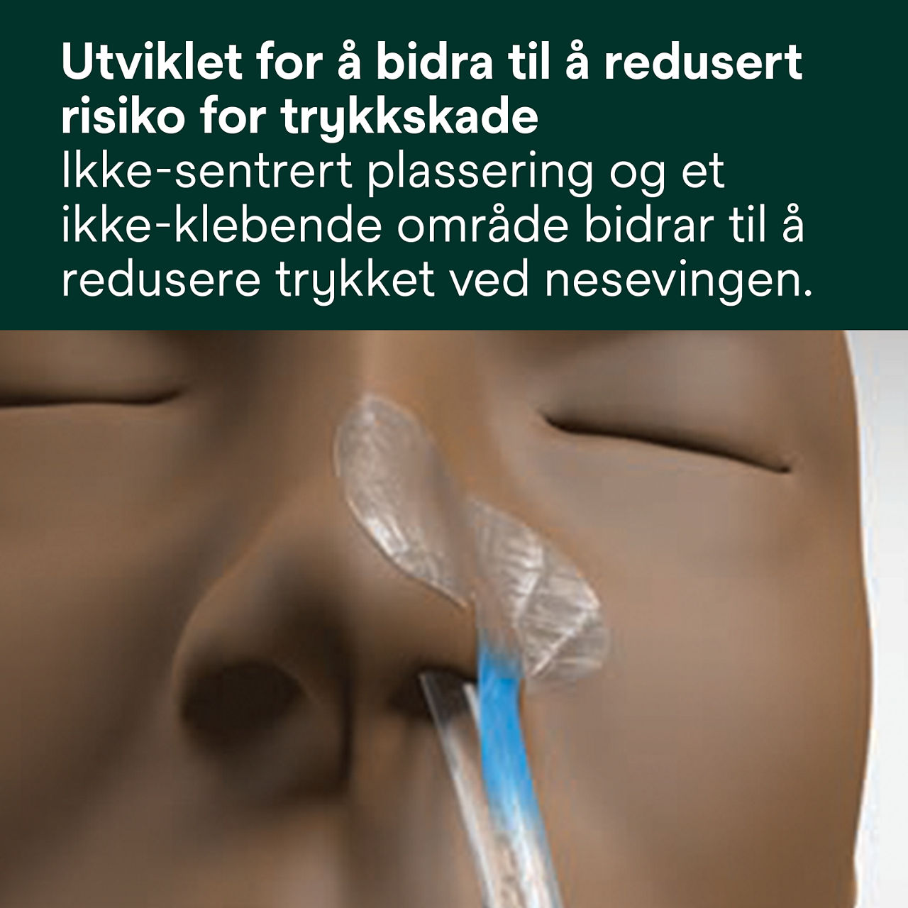 (1) Nasogastrisk fikseringsenhet: Designet for å redusere risikoen for trykksår
