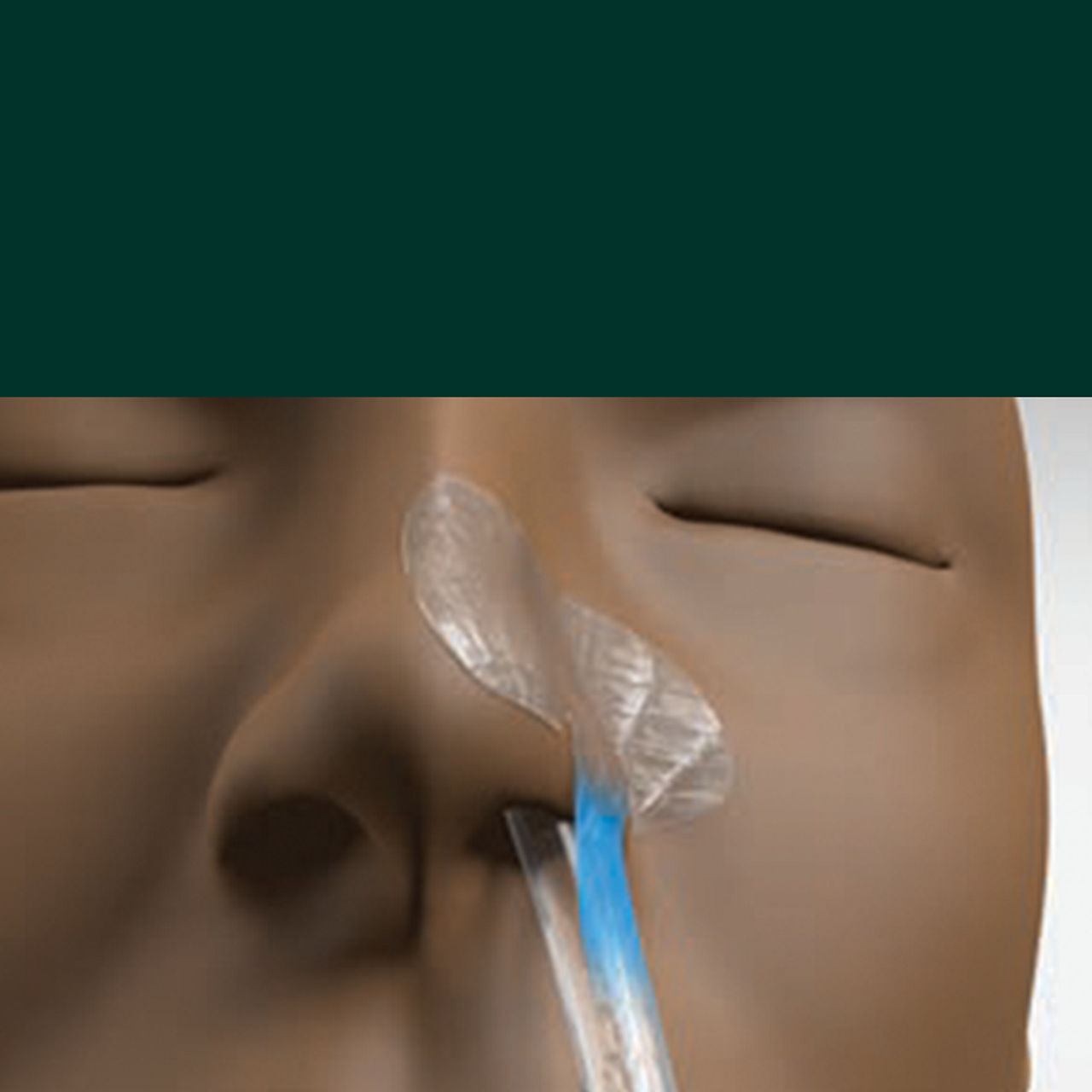 (1) Nazogastrik Sabitleme Cihazı: Basınç yaralanma riskini azaltmaya yardımcı olmak için tasarlanmıştır