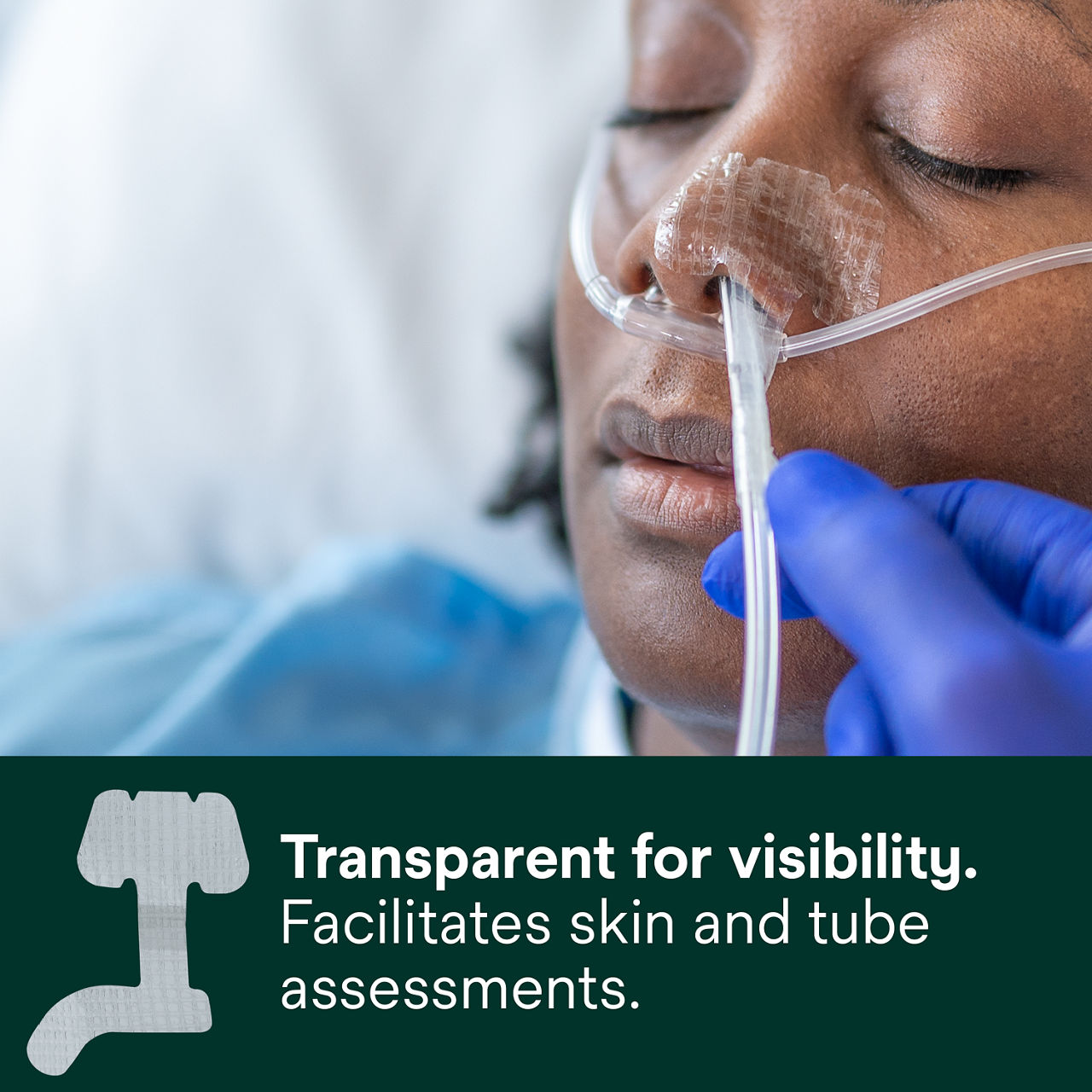 (2) Nasogastric Securement Device: Transparent for visibility facilitates skin and tube assessments