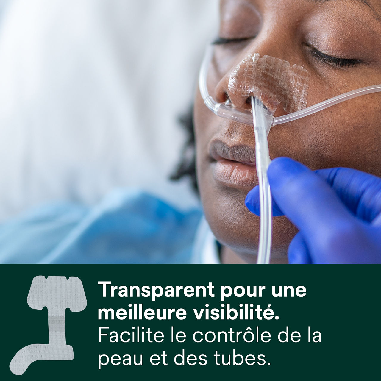 (2) Dispositif de fixation nasogastrique : Transparent pour la visibilité facilite l'évaluation de la peau et du tube