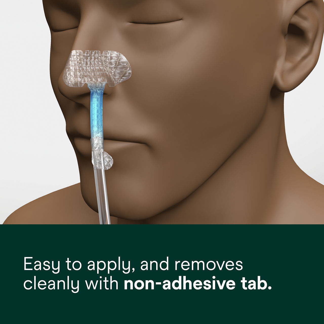 (4) Nasogastric Securement Device: Easy to apply and removes cleanly with non-adhesive tab