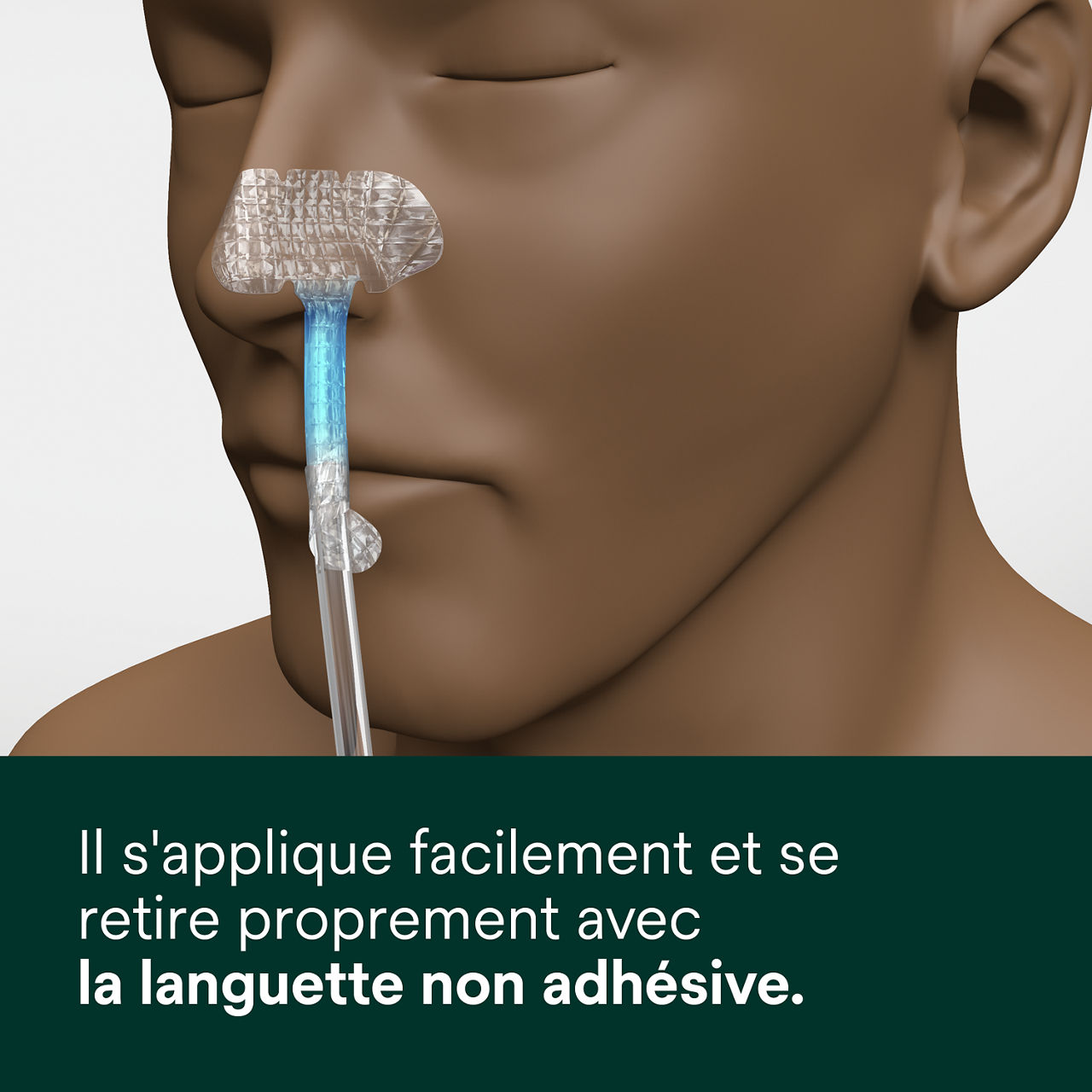 (4) Dispositif de fixation nasogastrique : Facile à appliquer et se retire proprement avec une languette non adhésive