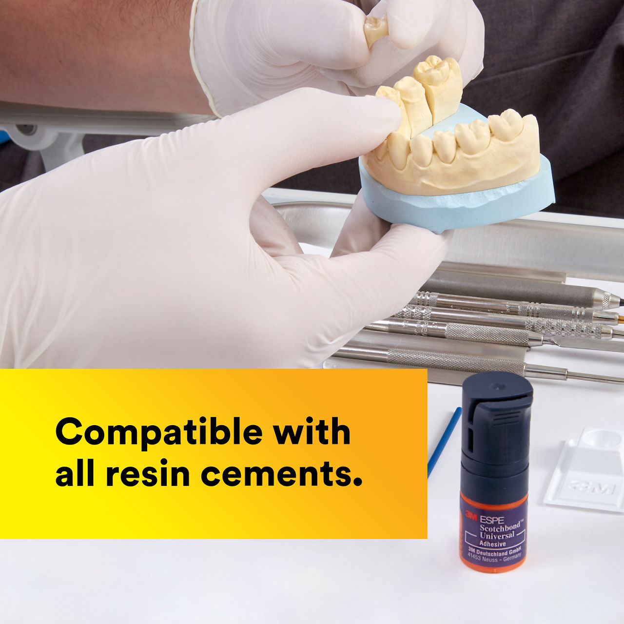(5) Scotchbond Universal Adhesive: Compatible with all resin cements-en-ca