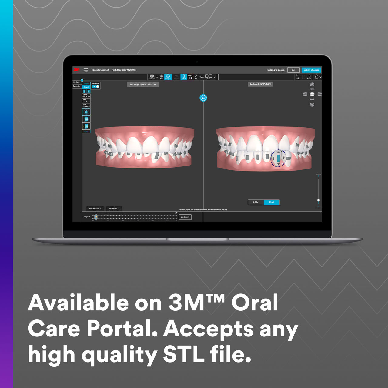 2 - Clarity Aligners: Available on 3M Oral Care Portal accepts any STL file