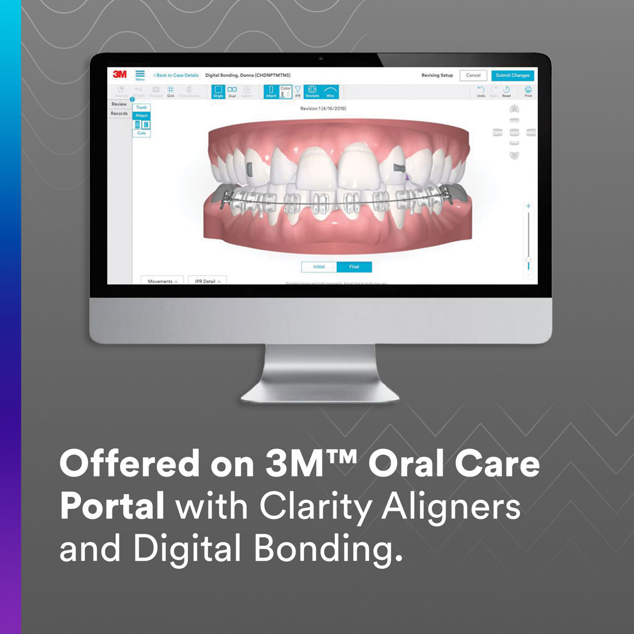 2 - Clarity Retainers: Offered on 3M Oral Care Portal with Clarity Aligners and Digital Bonding