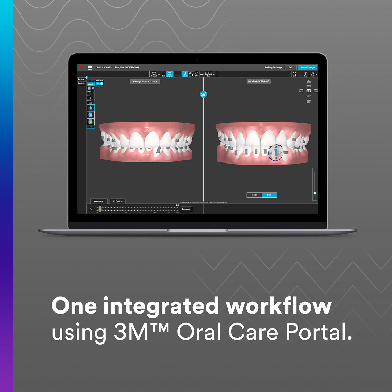 2 - Clarity Aligners Flex + Force: One integrated workflow using 3M Oral Care Portal