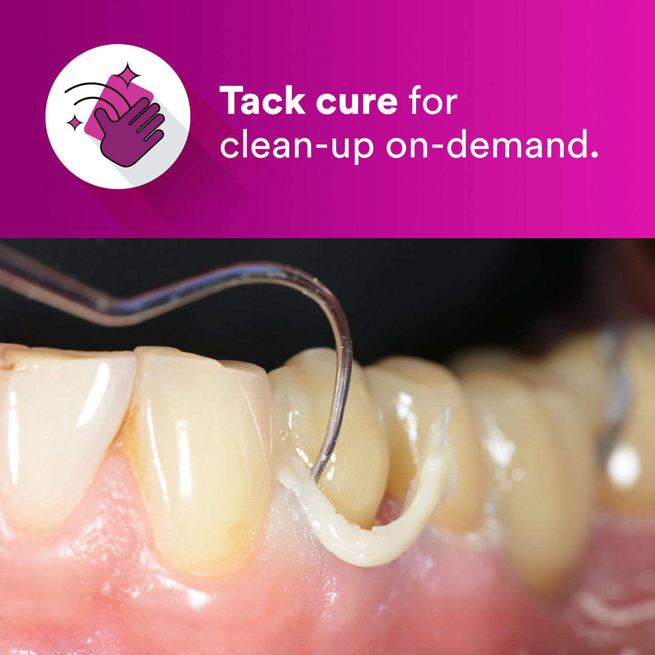(1) RelyX™ Luting Plus RMGI Cement: Tack cure for clean-up on-demand EN CA