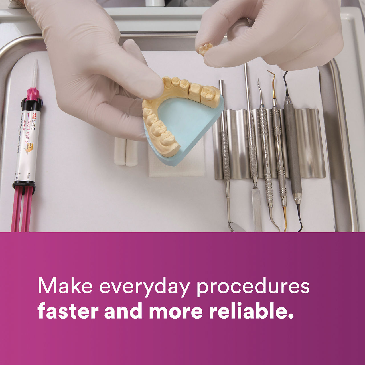 (2) RelyX Luting Plus RMGI Cement: Make everyday procedures faster and more reliable