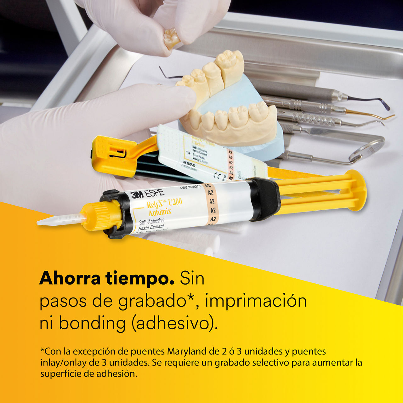 2-Cemento de resina autoadhesivo RelyX U200: Sin pasos de grabado*, imprimación o unión