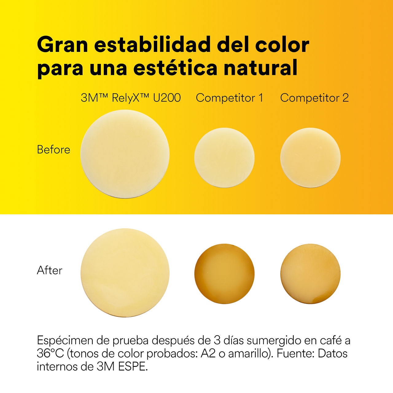 (4) Cemento de resina autoadhesivo RelyX U200: alta estabilidad del color para una estética natural