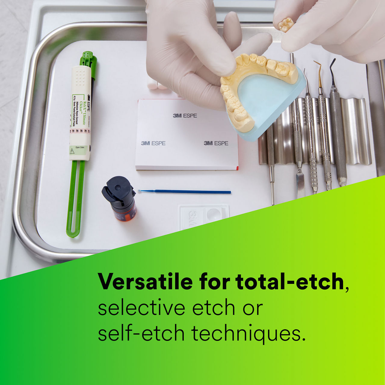 (3 - Clicker) RelyX™ Ultimate Adhesive Resin Cement: Total-etch, selective-etch or self-etch EN CA