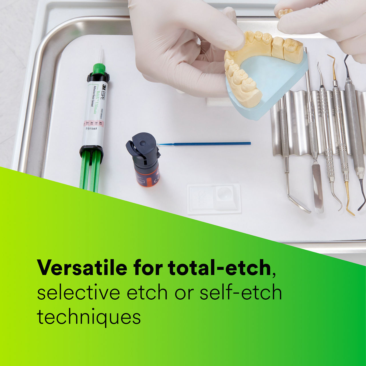 (3 - Syringe) RelyX™ Ultimate Adhesive Resin Cement: Total-etch, selective-etch or self-etch EN CA