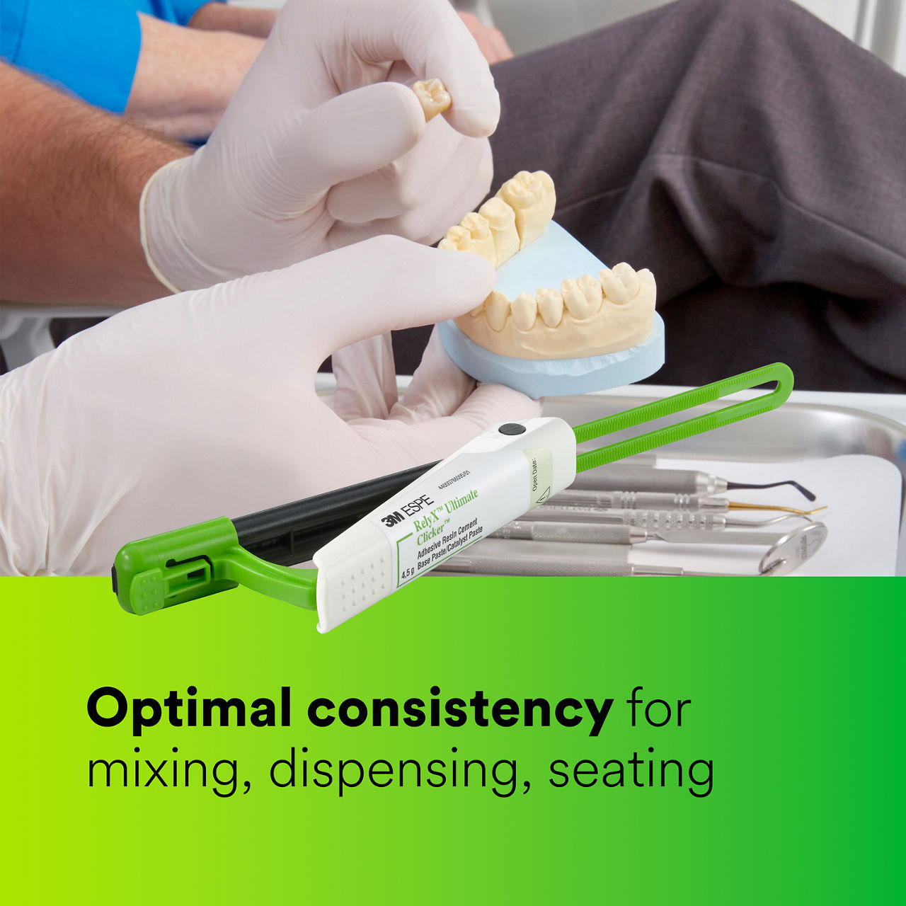 (4 - Clicker) RelyX™ Ultimate Adhesive Resin Cement: Optimal consistency EN CA