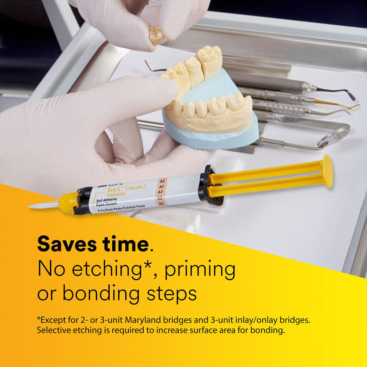 (2) RelyX™ Unicem 2 Self-Adhesive Resin Cement: Saves time. EN CA