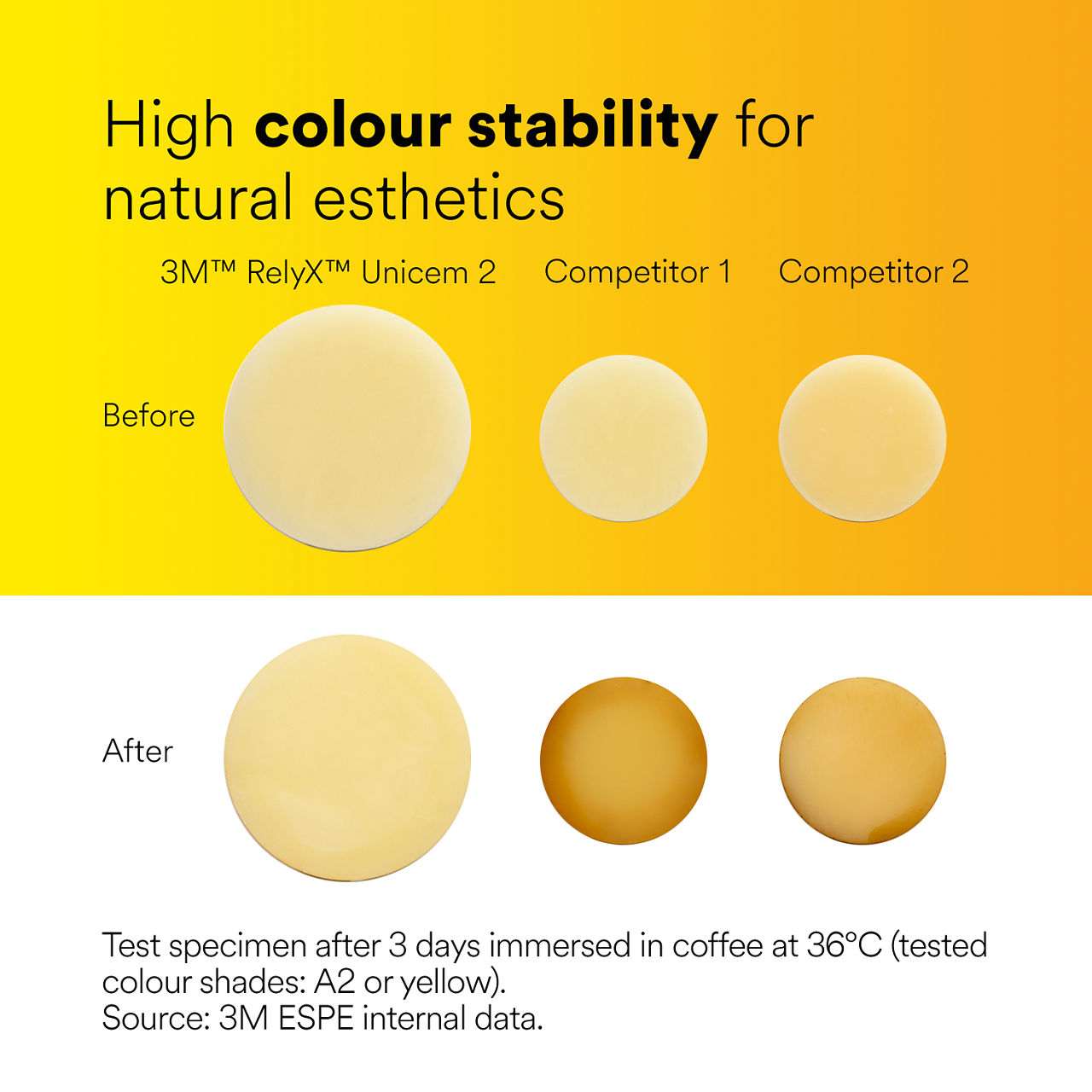 (4) RelyX™ Unicem 2 Self-Adhesive Resin Cement: High color stability for natural esthetics EN CA