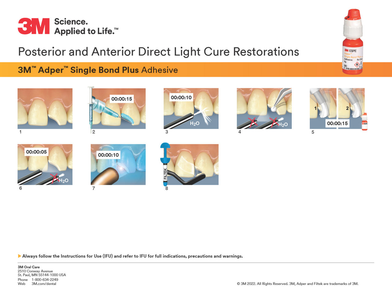 3M™ Adper™ Single Bond Plus Direct Restoration Technique Guide