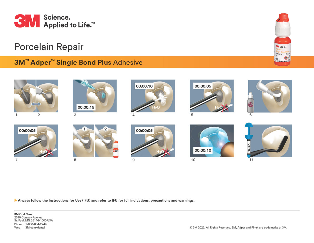 3M™ Adper™ Single Bond Plus Porcelain Repair Technique Guide