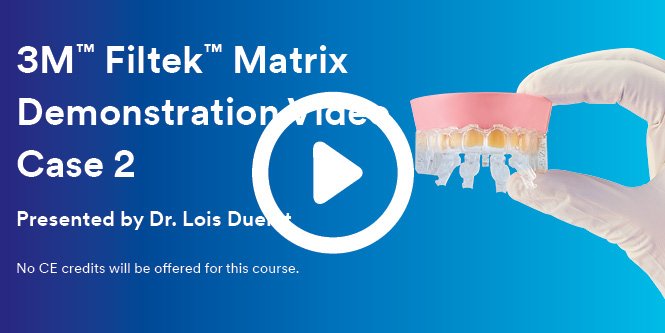 3M™ Filtek™ Matrix Demonstration Video Case 2, Presented by Dr. Lois Duerst, Case Study Image, 665x333, rgb, jpg