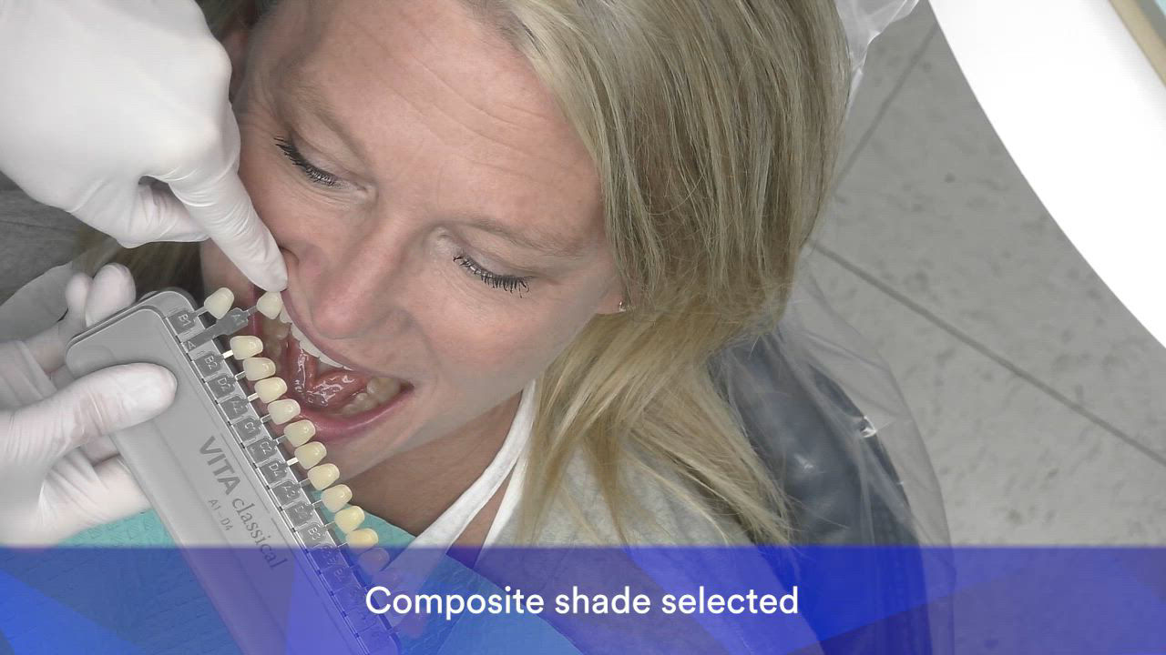 ocsd-den-filtekmatrix-patientcase-2-duerst-gbl.mp4