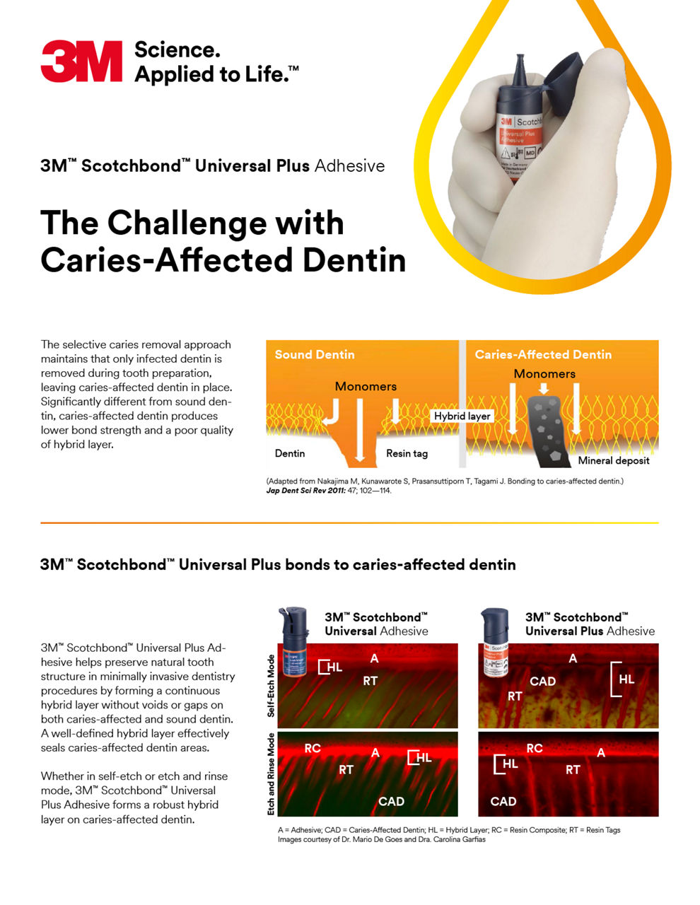 3M Scotchbond Universal Plus Caries Affected Dentin, EN, GBL