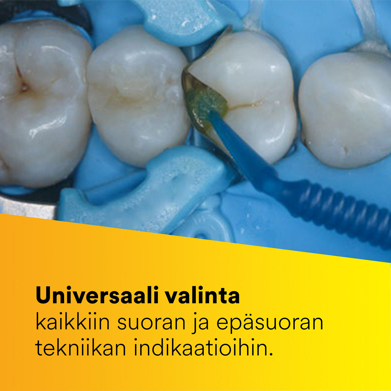 1 - 3M Scotchbond™ Universal Plus Adhesive