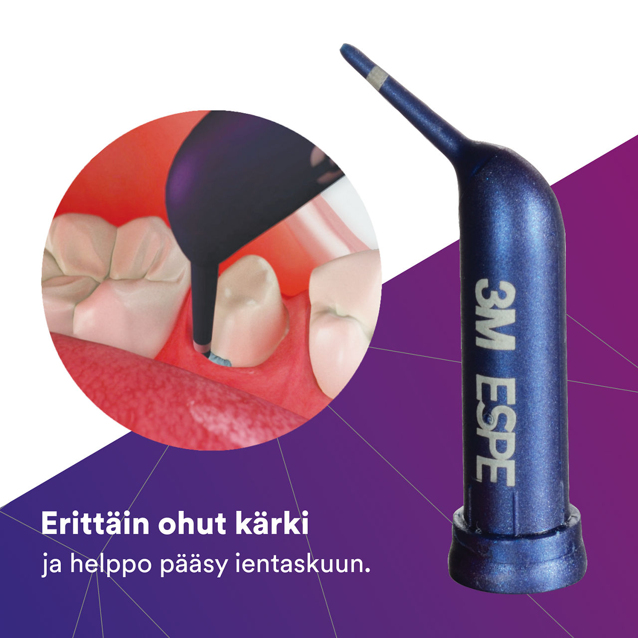 2- - Astringent Retractino Paste