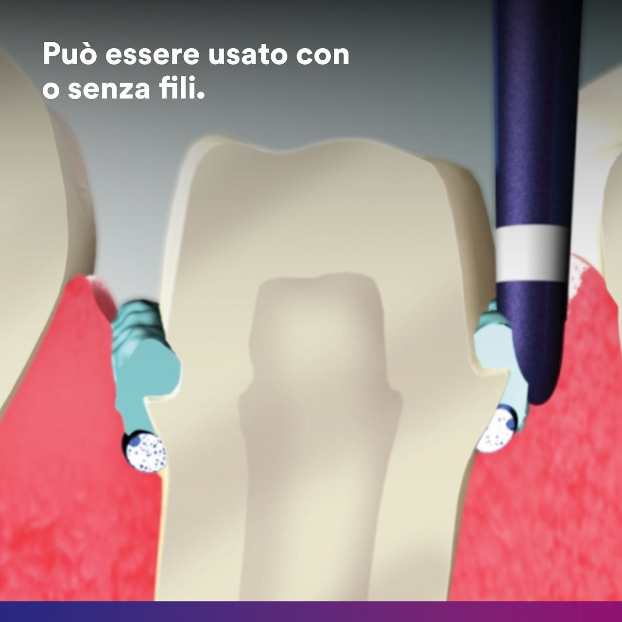 4- - Pasta di retrazione astringente