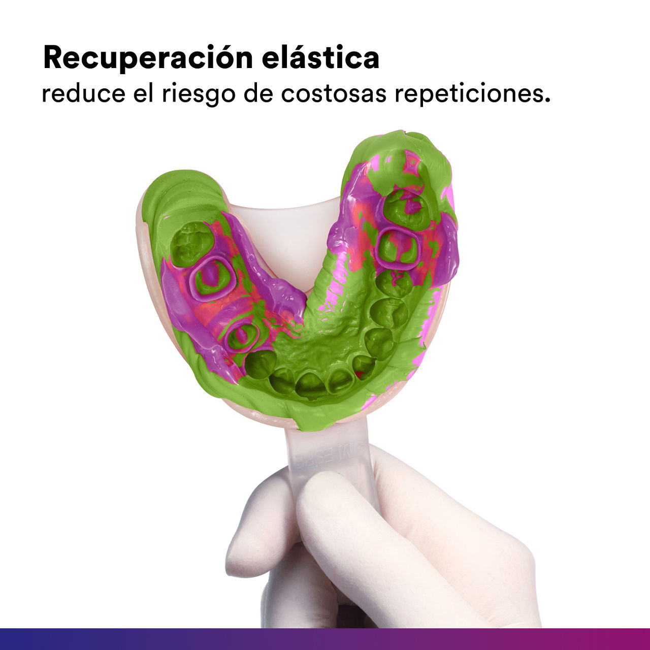 (2 - Regular)Material de impresión Express™ XT VPS:Resiste a desgarros debido a su resist general