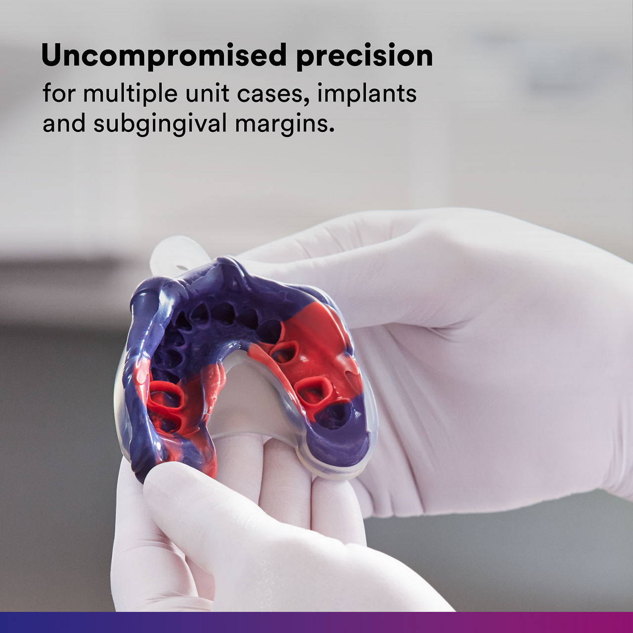 (1) Impregum Polyether Impression Material: Uncompromized precision