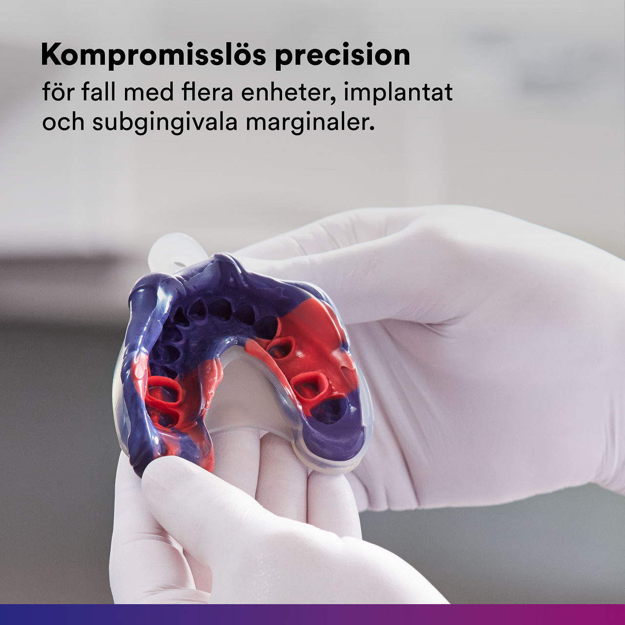 1- Impregum™ - Polyether Impression Material