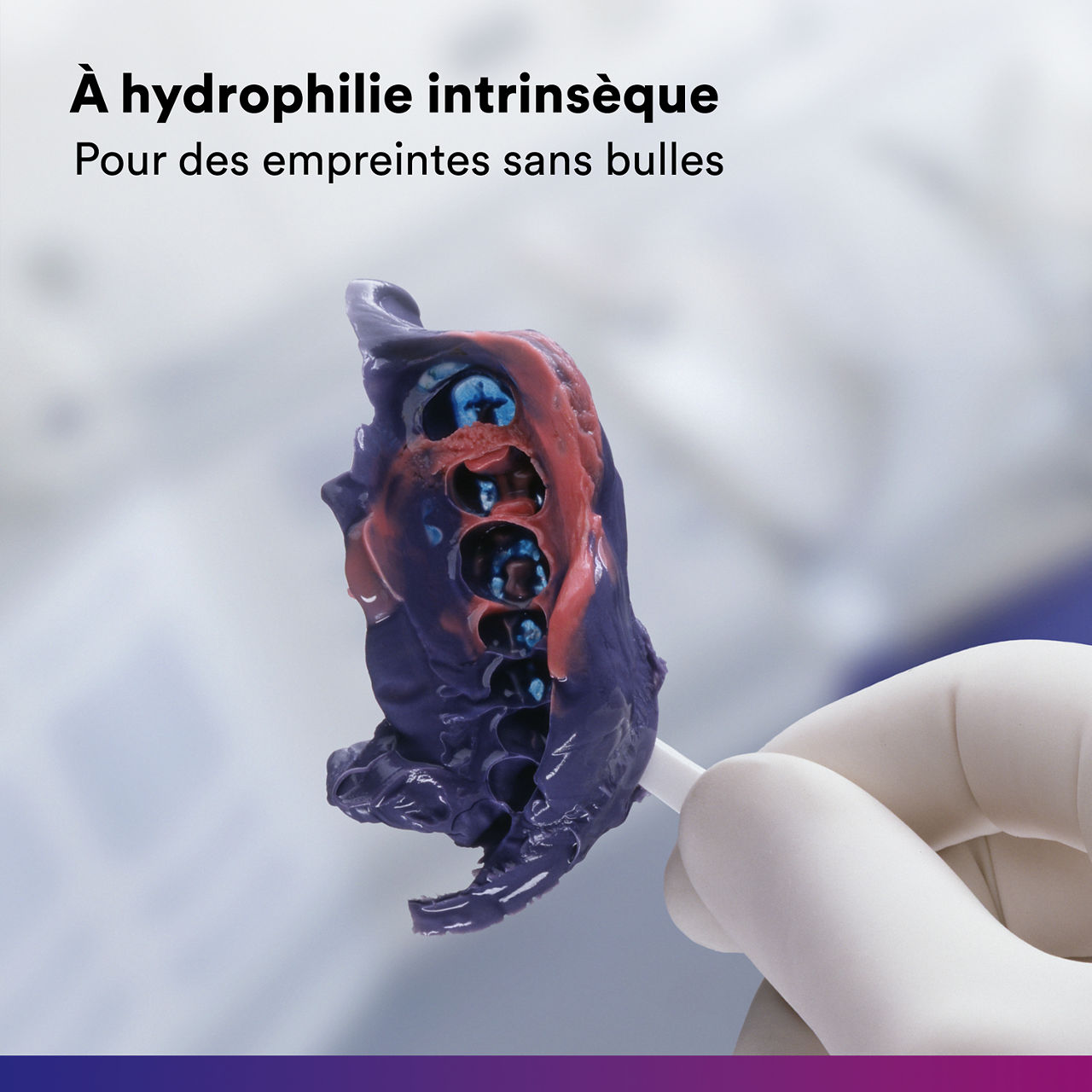 2- Impregum™ - Matériau d'empreinte polyéther