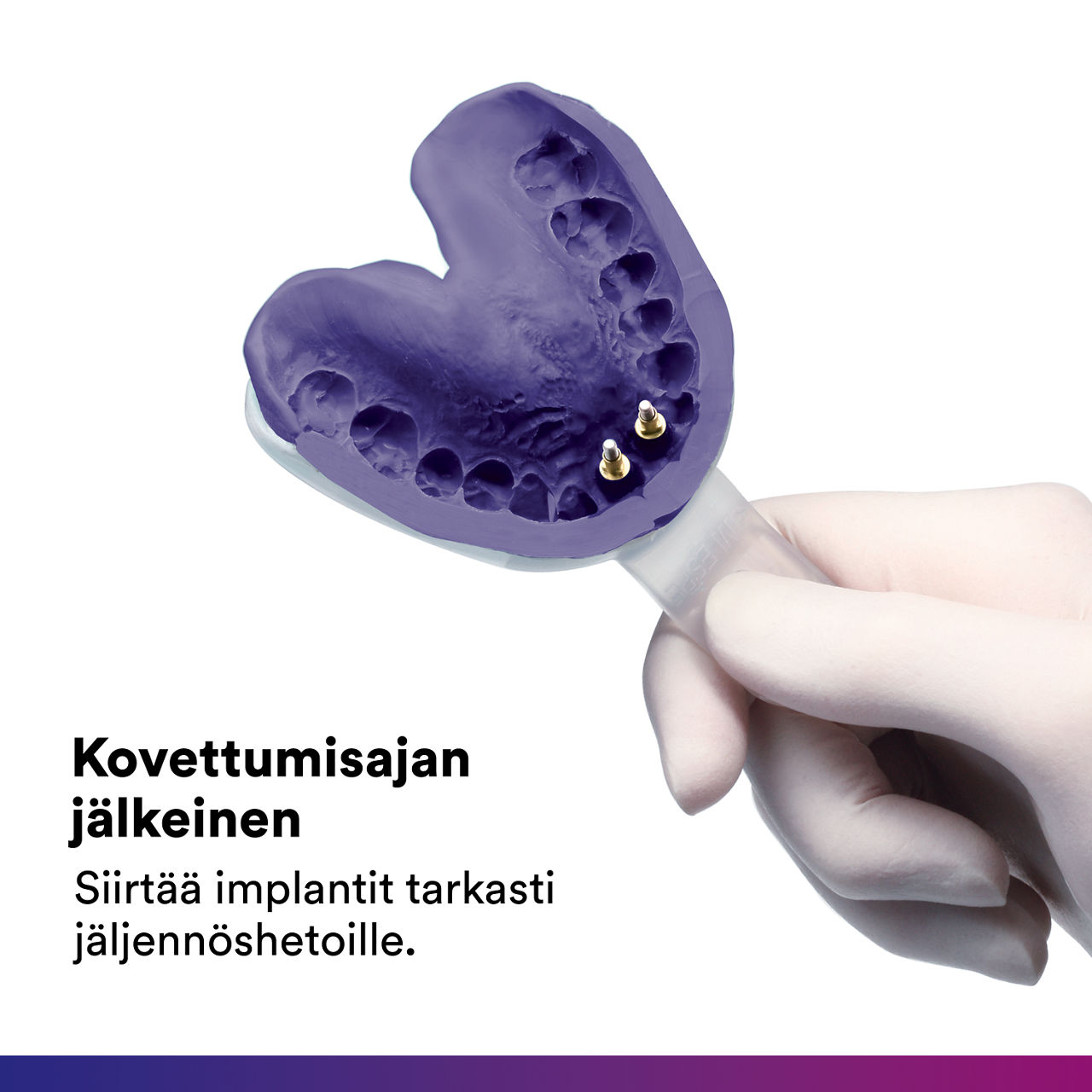 5- Impregum - Polyether Impression Material