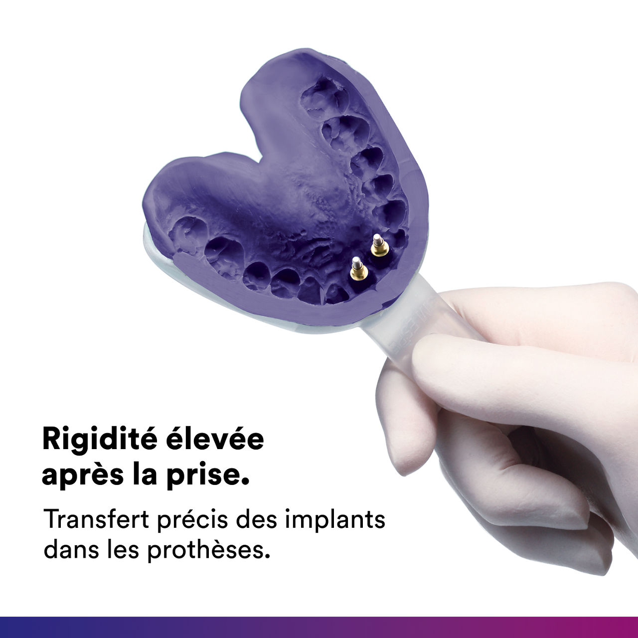 5- Impregum™ - Matériau d'empreinte polyéther