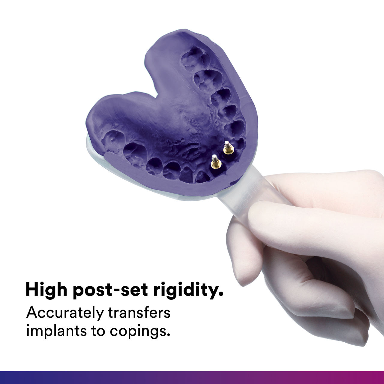 (5) Impregum Polyether Impression Material: High post-set rigidity