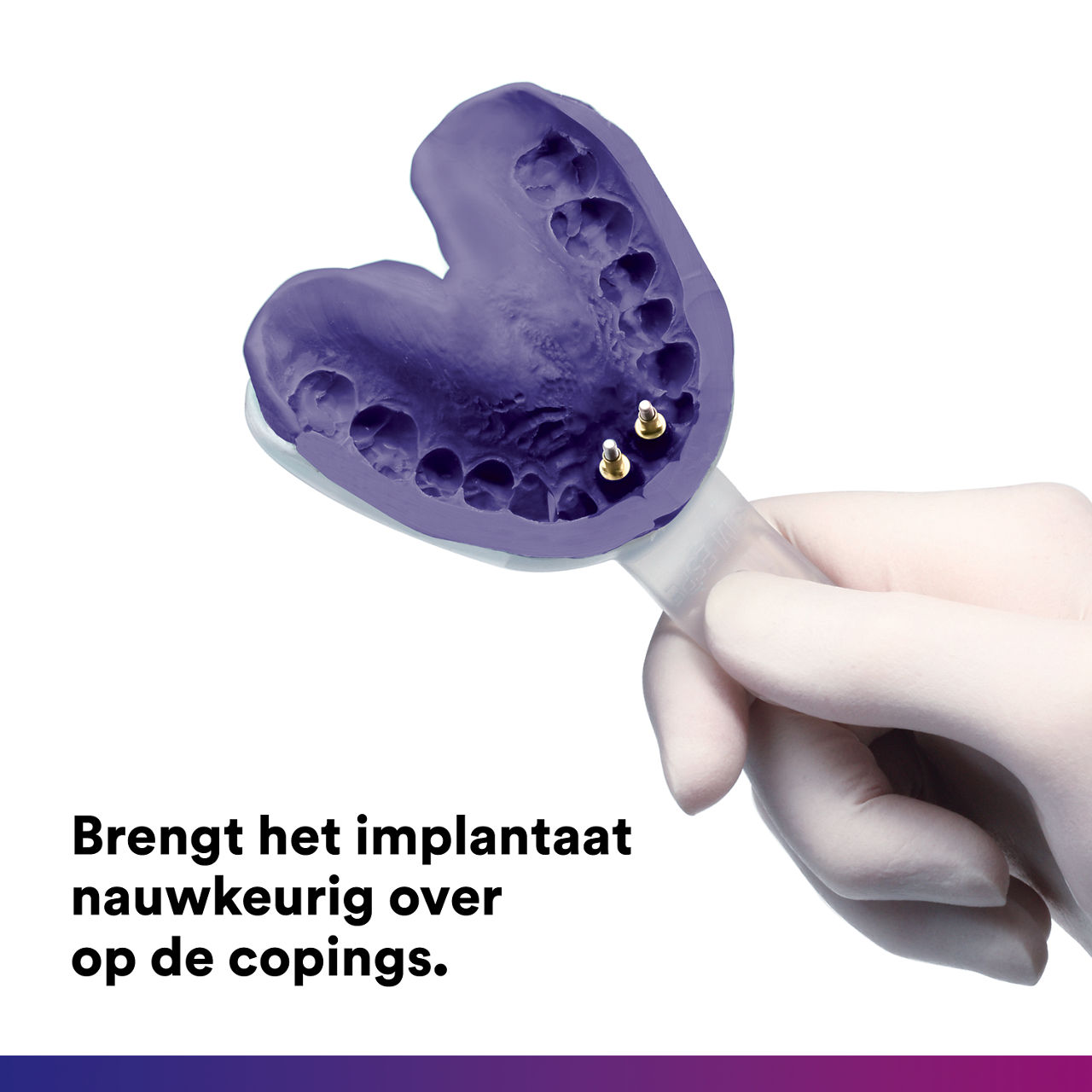 5- Impregum™ - Polyether Afdrukmateriaal