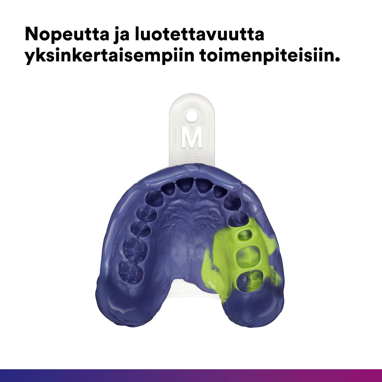 2- Impregum Super Quick -  Polyether Impression Material