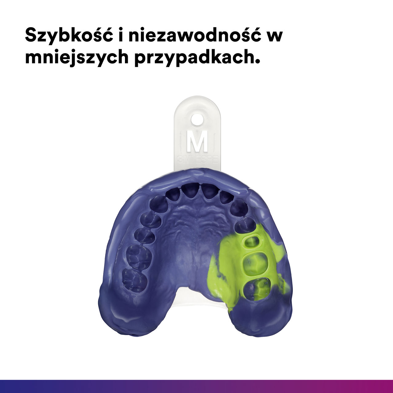 (2) Impregum Super Quick : Speed & reliability