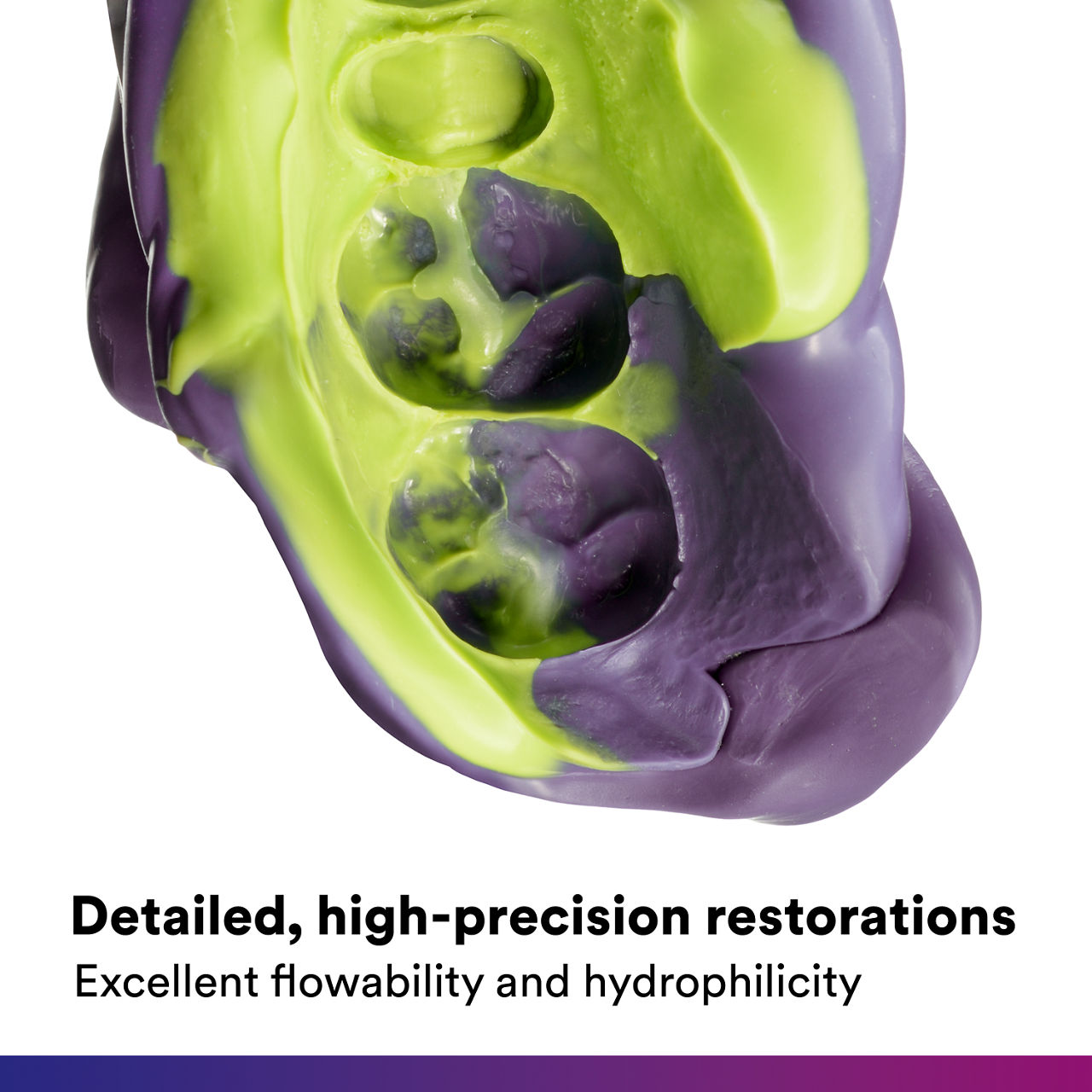 (3) Impregum Super Quick : Detailed, high-precision restorations.