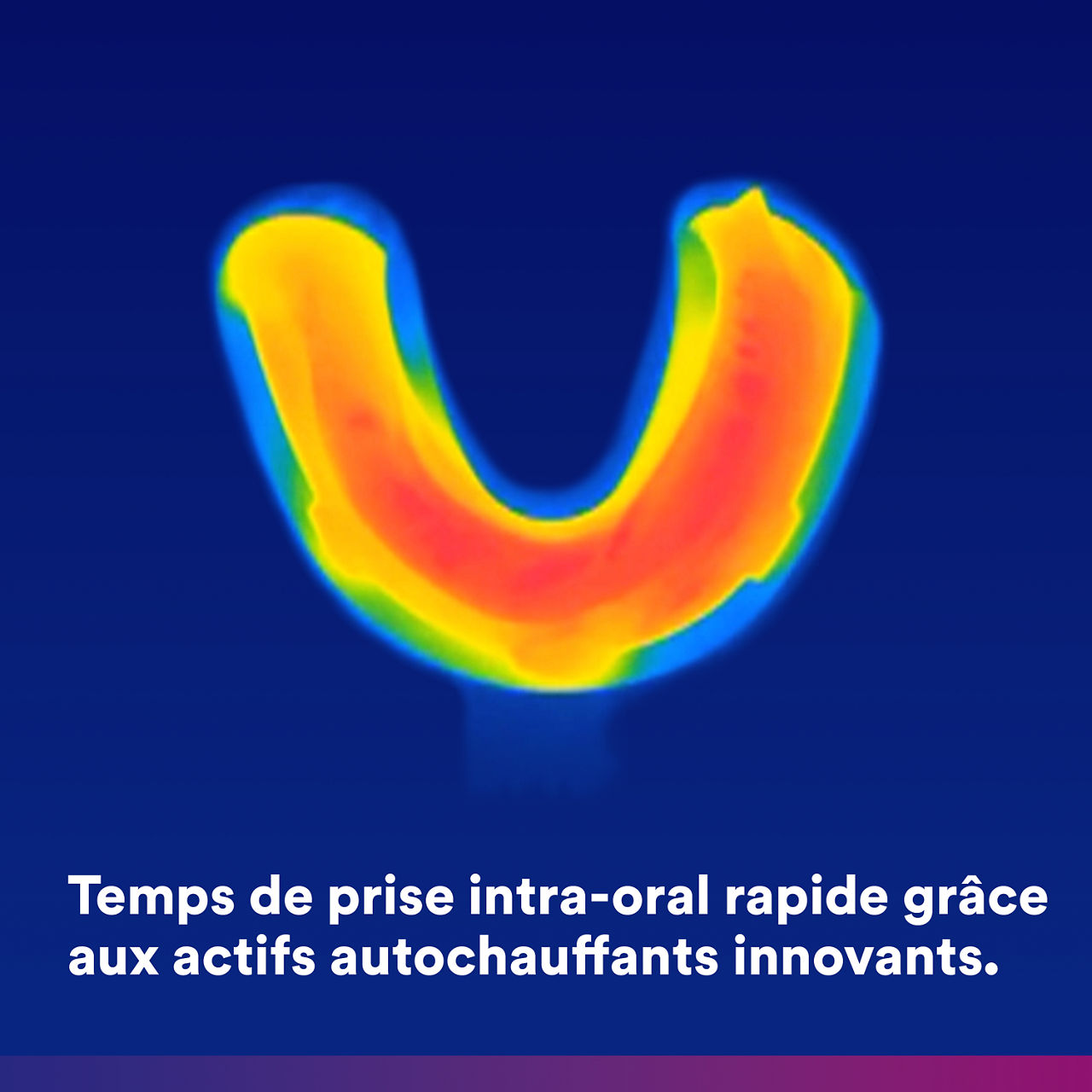 (1) Imprint 4 VPS: Fast intra-oral setting time with active warming.