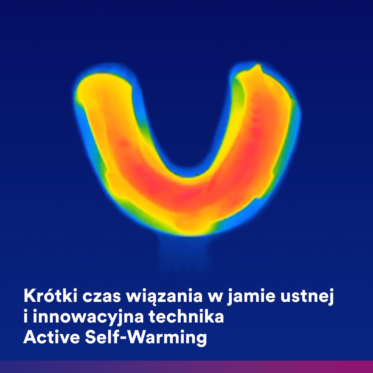 (1) Imprint 4 VPS: Fast intra-oral setting time with active warming.