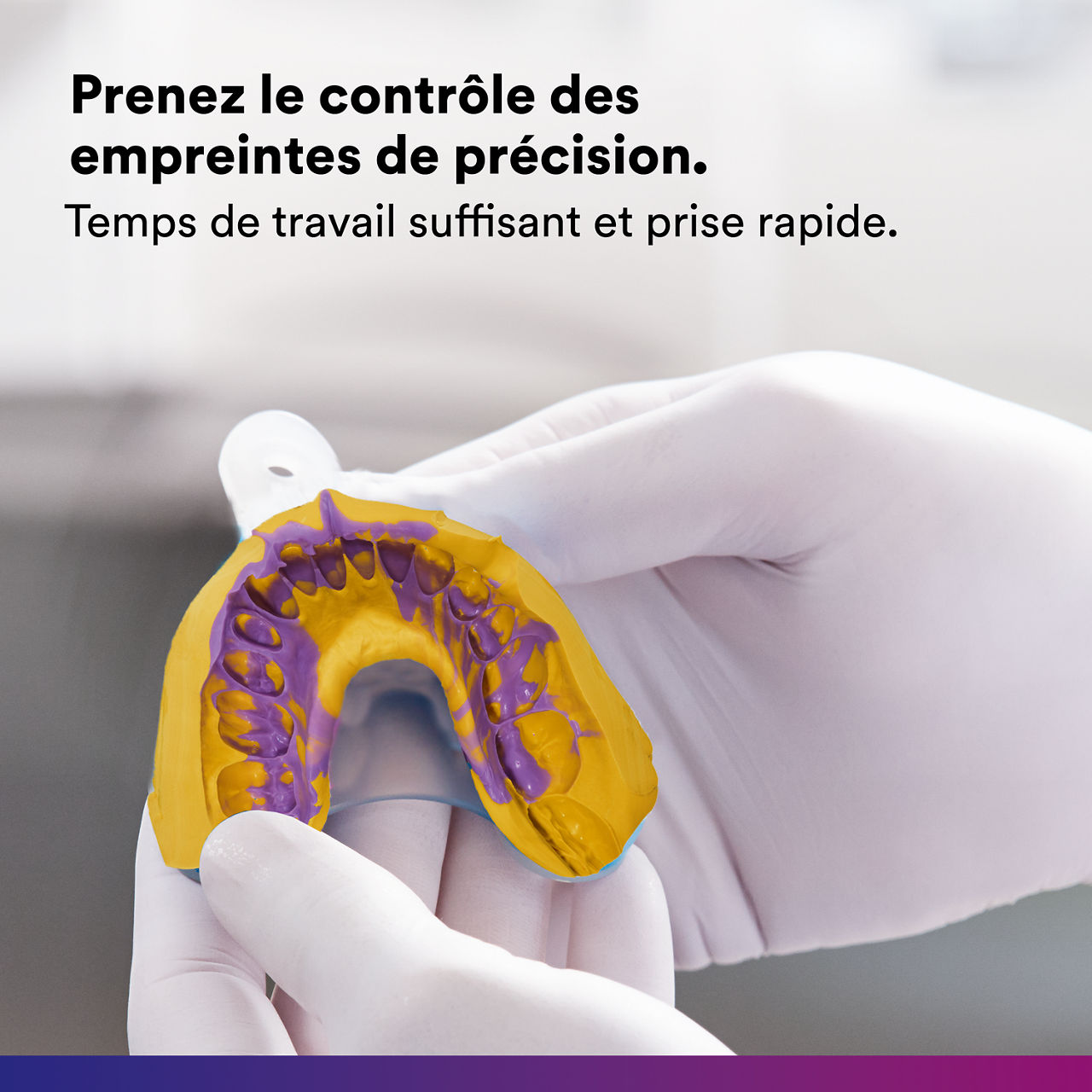 (2 - Quick) Imprint 4 VPS: Take control of precision impressions.