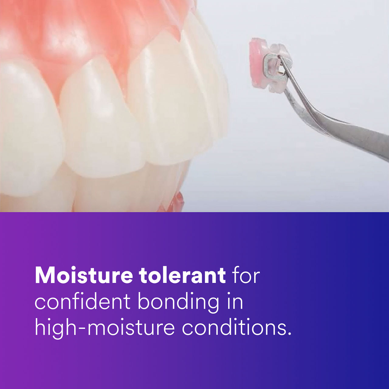 (2) Transbond Plus Color Change Adhesive: Moisture-tolerant for confident bonding