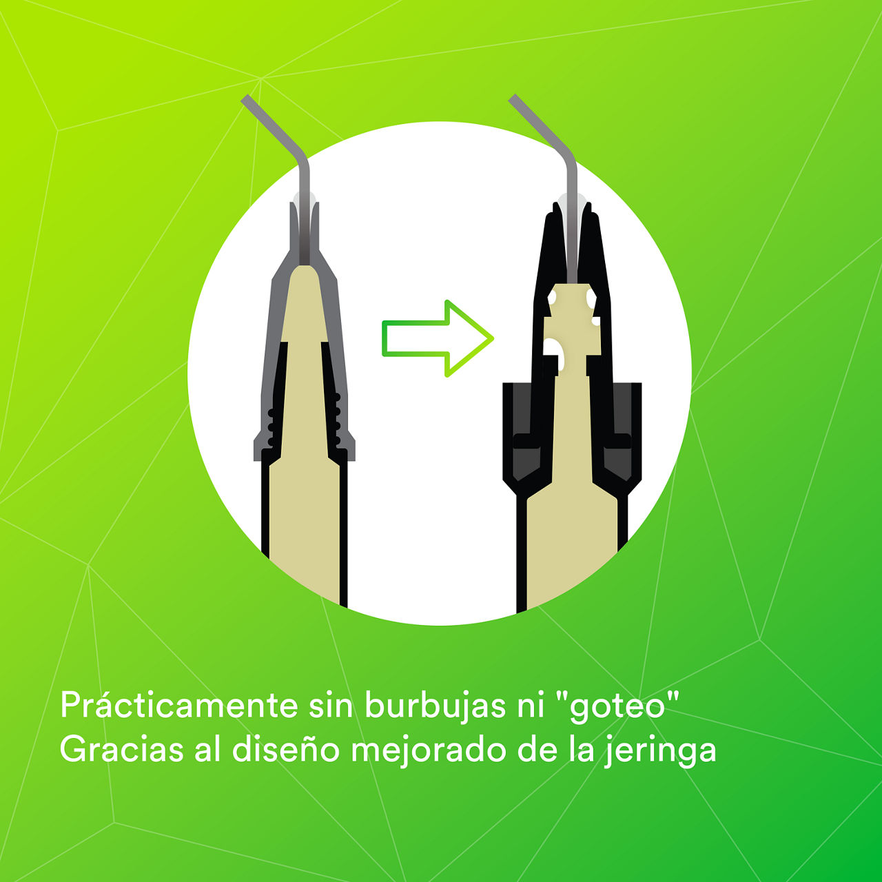 (2) Jeringa Filtek Bulk Fill Flowable: Prácticamente sin burbujas ni " goteos "