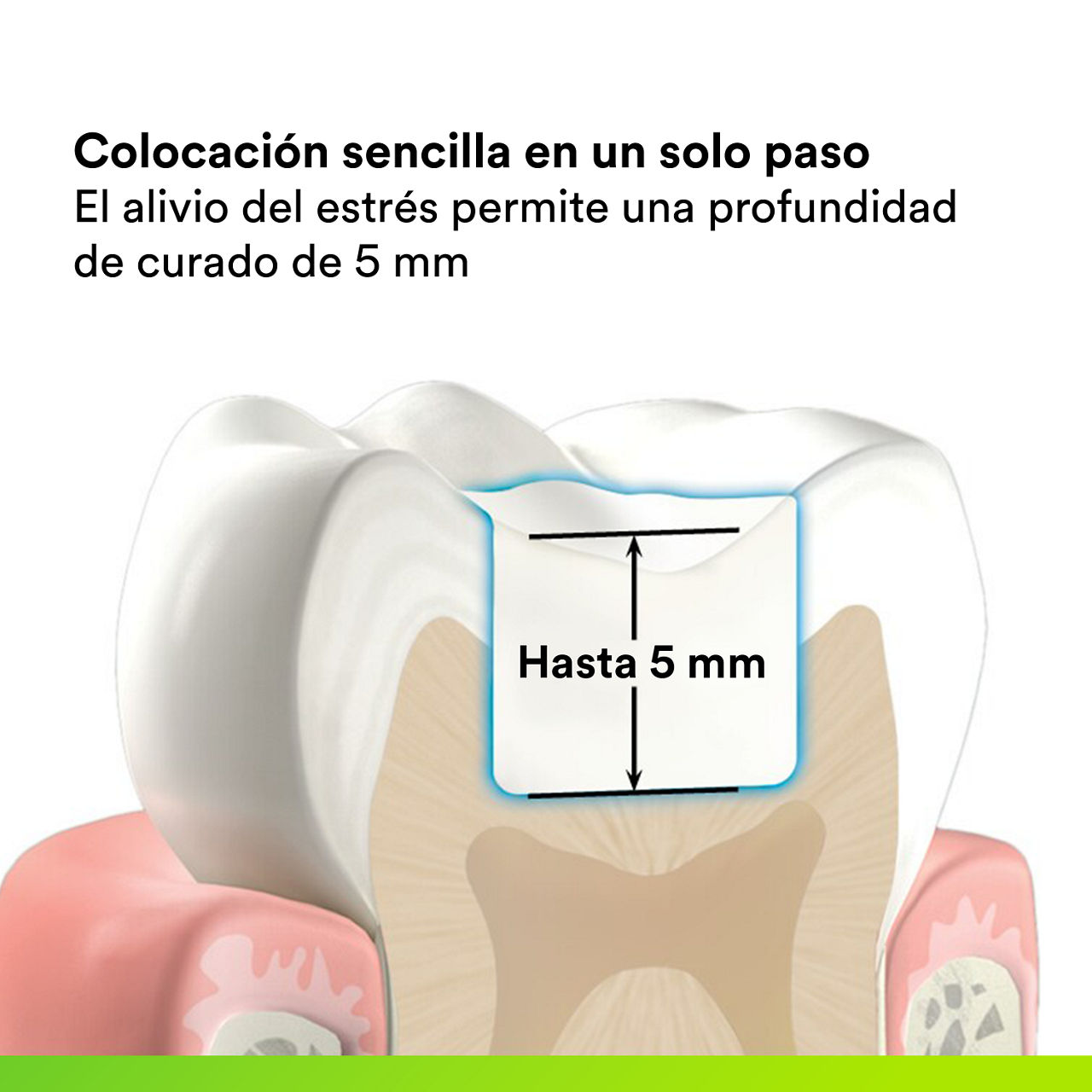 (2)  Filtek One Bulk Fill Rostorative: Colocación sencilla en un solo paso