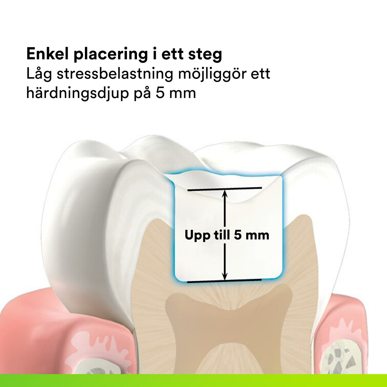 (2) 3M™ Filtek™ One Bulk Fill: Simple One-Step Placement