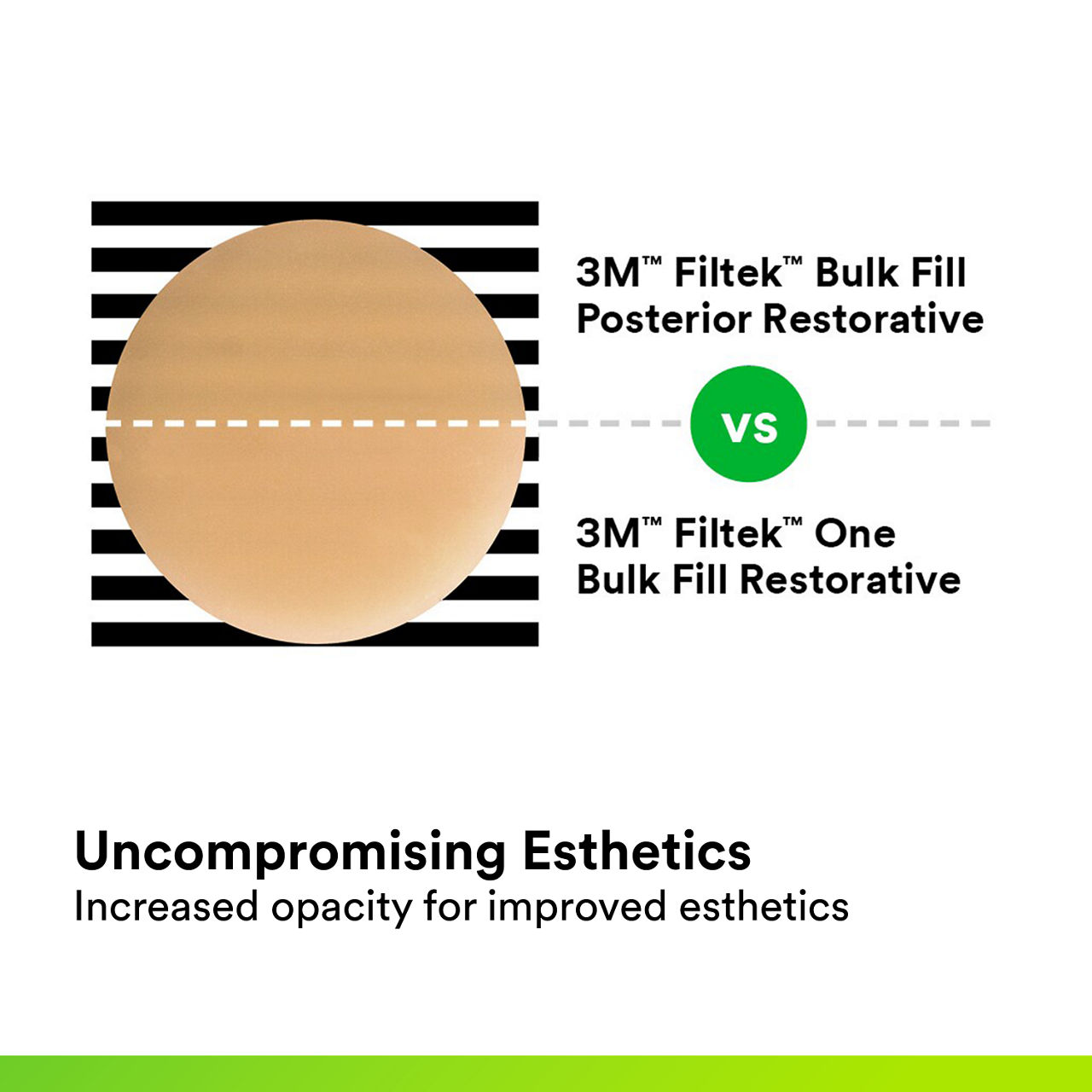 (3) 3M™ Filtek™ One Bulk Fill: Uncompromising Esthetics