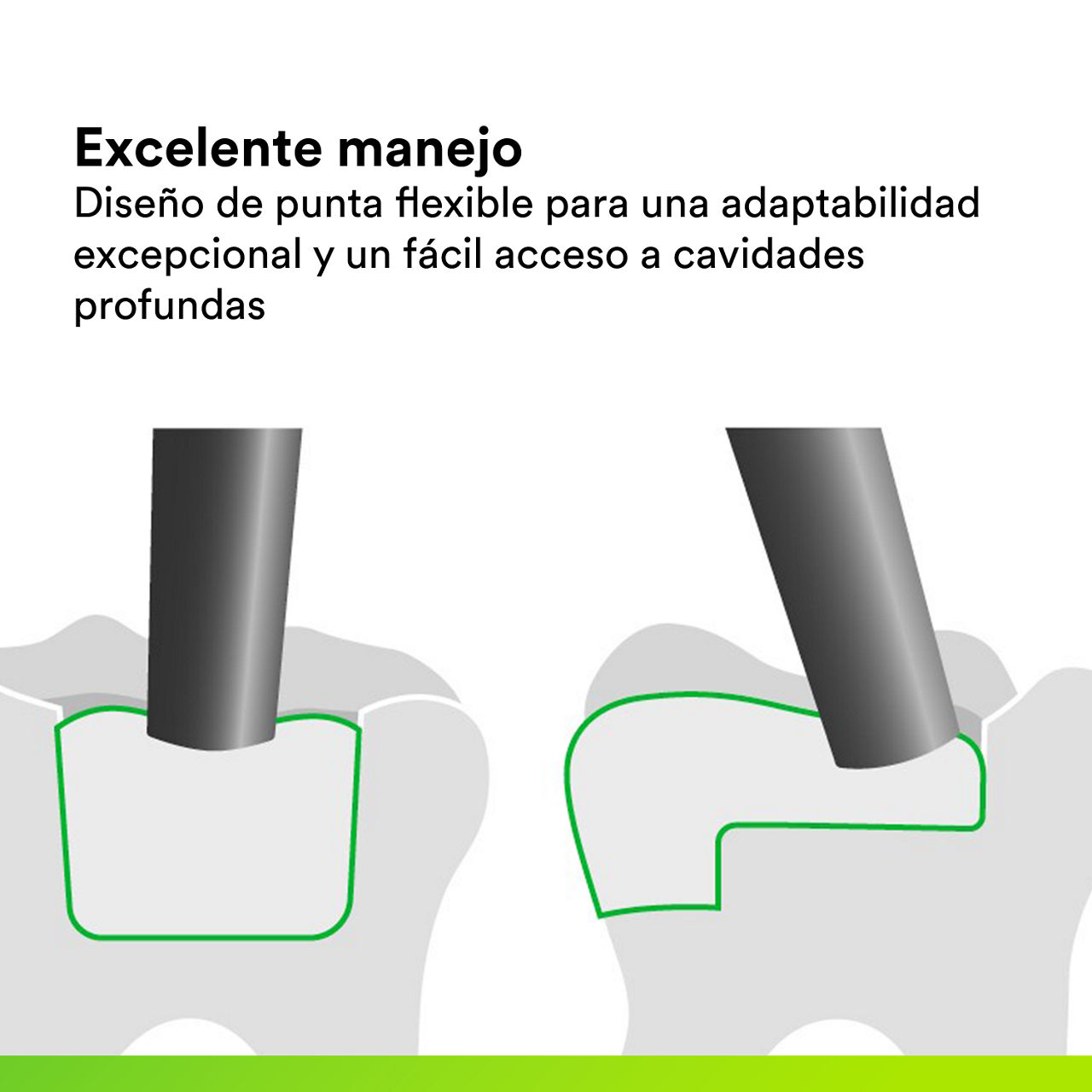 (4)  Filtek One Bulk Fill: Excelente manipulación.