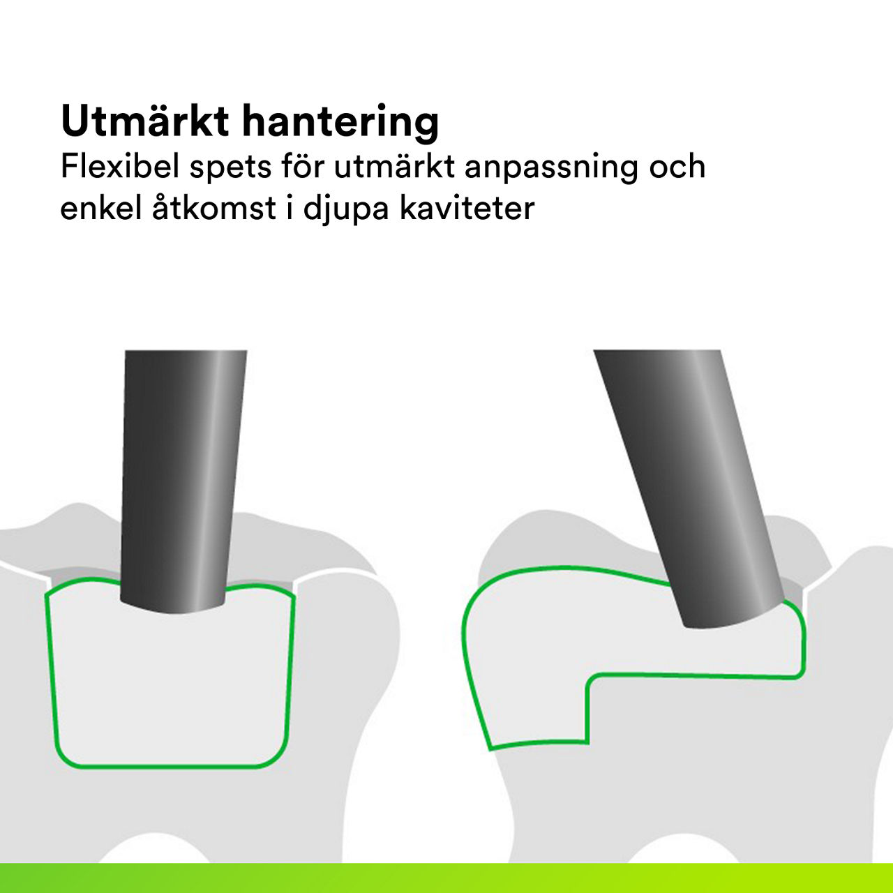 (4) 3M™ Filtek™ One Bulk Fill: Excellent Handling